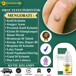 Obat Oles Penghilang Kutil - Peprontok Kutil Kelamin Papiloma - Jengger Ayam Miss V - Propolis Sm Alami Tanpa Efek Samping