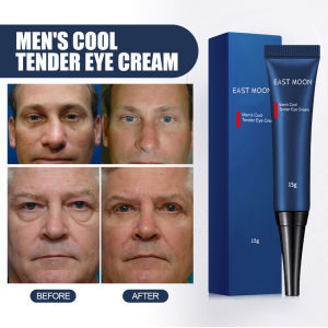 Kem OpenEyes xóa tan bọng mắt thâm quầng nhập khẩu chính hãng 15gr trẻ trung vùng mắt