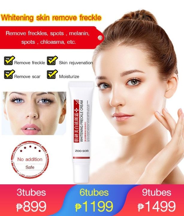 Whitening Anti-Freckle Moisturizing Cream/Remove Dark Spots Freckle ...