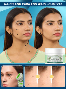 Herbal Mint Body Wart Removal Cream for All Year Round Adults  Men and Women  Nourishing Skin  Joint Care  Effective Wart Removal