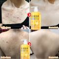 Sumifun Beauty Eczema Body Wash 500ml / Sabun Eksim / Sabun Gatal Kulit Ampuh / Sabun Jerawat Punggung / Sabun Mandi Cair. 