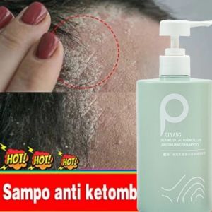 Shampo anti ketombe Shampo rambut rontok mite removal Shampo penumbuh rambut cepat Jahe ketombe / oil control 500ml
