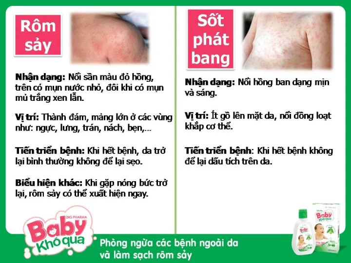 COMBO%203%20H%E1%BB%98P%20S%E1%BB%AEA%20T%E1%BA%AEM%20BABY%20KH%E1%BB%94%20QUA%20TR%E1%BB%8A%20R%C3%94M%20S%E1%BA%A8Y.%20M%E1%BA%AAN%20NG%E1%BB%A8A,%20H%C4%82M%20DA%20CHO%20TR%E1%BA%BA%20-%20Image%206