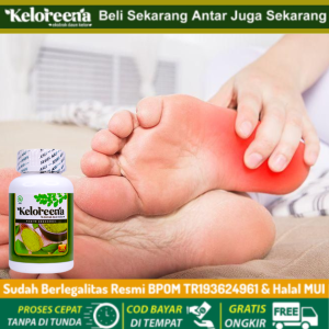 Obat Sakit Tumit Plantar Fascia Obat Sakit Tumit Ketika Berjalan Sakit Tumit Saat Berjalan Obat Radang Tumit Radang Tumit Bengkak Plantar Fasciitis Muscle Pull Sakit Telapak Kaki Telapak Kaki Panas Kaki Kesemutan Asam Urat Herbal Alami Keloreena
