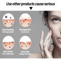 Acne Cream whitening moisturizing cream acne removal essence 30g facial essence cream scar acne remo Pimple Eraser. 