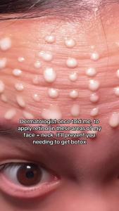 [Reday stock]SOME BY MI  Retinol Intensive Revitalizing Serum  – 1  Ounce 30  Ml  –  South Korea Bakuchiol  Retinol Essence  –  Improve signs of aging  Reduce pore size  Improve skin texture  –  Korean Skin Care