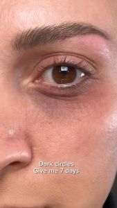 ANUA Nano Retinol 0.1% + Caffeine Revitalizing Eye Cream 30ML