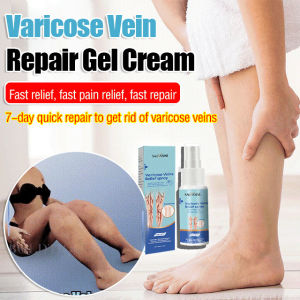 Varicose Vein Massage Spray Veinpampering Cream