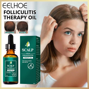 Eelhoe Hair Regrowth Serum Liquid Hair Care Essential Oil Herb Care Scalp Folliculitis Therapy Oil Hair Loss Products Hair Growth Deeply Clean All Dust Eliminate Head Sores Soothe And Nourish Scalp Hair Care Essential Oil Hair Care Product 30ml