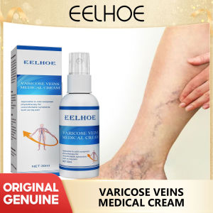 Eelhoe Vein Massage Varicose Spray Relieves Venation Smoothes Earthworm Leg Relieves Pain Of Leg Vascular Protuberance Varicose Veins Spray Massage Varicose Relieves Veins Earthworm Legs Spray To Relieve Leg Pain Blood Vessel Bulging Spray