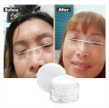 Penghilang Flek Hitam Paling Ampuh BPOM Salep Flek Hitam Ampuh Untuk Menghilangkan Flex Hitam Melasma Salep Flek Melasma Membandel Krim Penghilang Flek Hitam Di Wajah Permanen Cream Flek Khusus Flek Bandel Glowing Cream Leika Penghilang Flek Hitam Melasma. 