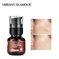 VIBRANT GLAMOUR Crocodile Scar Repair Toner Fade Scar Prevent Scar Hyperplasia Sensitive Skin Deep Care. 