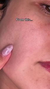 APRILSKIN TXA Niacinamide Toning Shot Serum Brightening Facial Serum with TXA & Niacinamide - Pore Care 1.01 fl. oz.