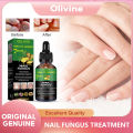 EELHOE Nail Fungus Repair Liquid Remove Onychomycosis Treatment Essence Serum Anti-infective Nourishing Brighten Foot Nail Oil Anti-Fungus Onychomycosis-Removal Liquid Ginger Foot Antifungal Nail Essence. 