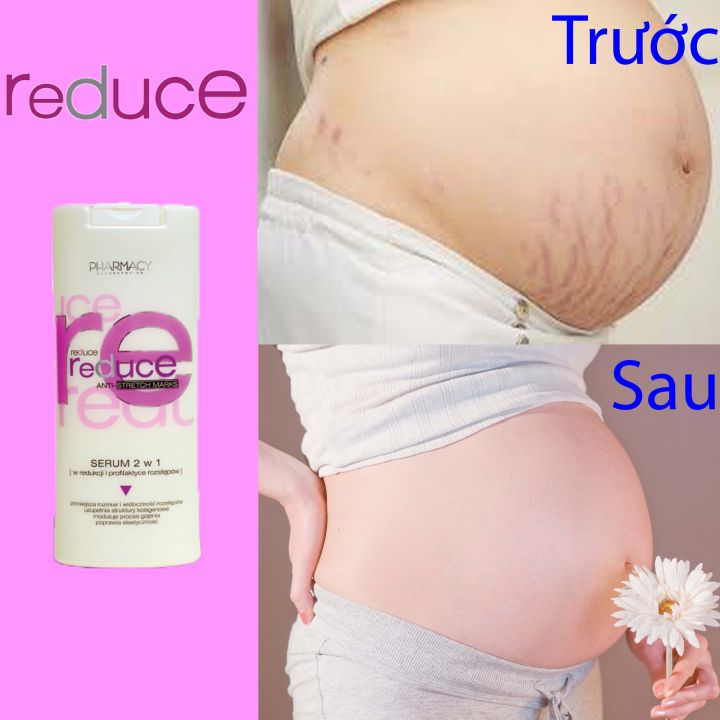 Kem%20r%E1%BA%A1n%20da%20reduce%20-%20Image%208