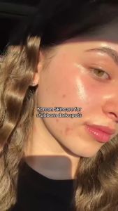 Niacinamide 10% + TXA 4% Dark Spot Serum Melasma Sunspots Acne Scars Remover Whitening Serum