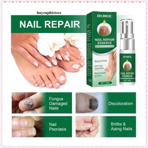 [ GIẢM SỐC ] Dung Dịch Xịt Nấm Móng Tay Chân Hỗ Trợ Giảm Ngứa Rát Diệt Khuẩn Dưỡng Móng Tự Nhiên Hiệu Quả