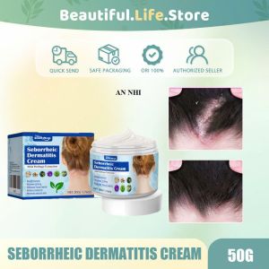 Kem Bôi Nấm Da Đầu Hiệu Quả Tận Gốc - Hết Ngứa Sạch Gàu Giảm Rụng Tóc - Cho Da Đầu Khỏe Mượt