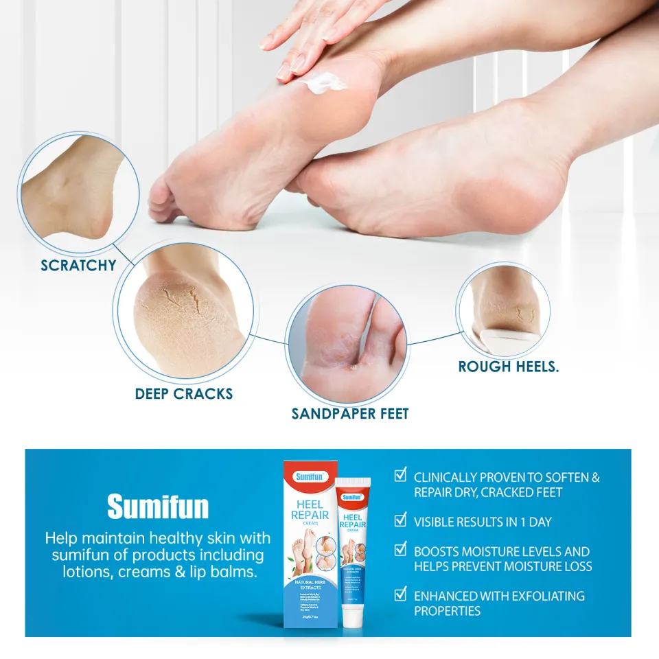 COD]Sumifun foot cream cracked heel remover hand cream for dry hands Foot  cream for Cracked
