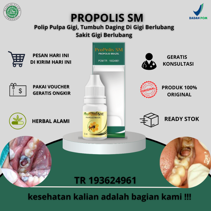 Gambar Gigi Berlubang Tumbuh Daging