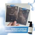 Bonvie Anti Dandruff Kemiri Tea Hair Tonic 60ml - Tonik Rambut Bonvie Anti Ketombe. 