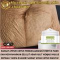 Vova Strechmark cream krim penghilang stretchmark stretchmark selulit. 