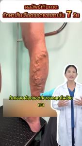 【COD】Kreain Nature เจลลดปวดขา ช่วยแก้ปัญหาอาการปวดกล้ามเนื้อขาและเส้นเลือดขอด รวมถึงข้อกังวลอื่นๆ