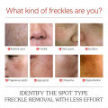 EELHOE Pigment Correcting Cream Freckles Removal Cream Pigment Correcting Serum Remove Melasma Age Spots Sunspots Whitening Freckle Removing Cream Effective Brightening Essence Remove Pigment Melanin Correct Beauty Facial Skin Care. 