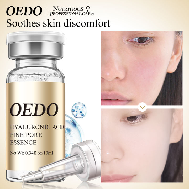 OEDO%20Serum%20tinh%20ch%E1%BA%A5t%20c%E1%BA%A5p%20%E1%BA%A9m%20se%20kh%C3%ADt%20l%E1%BB%97%20ch%C3%A2n%20l%C3%B4ng%20l%C3%A0m%20m%E1%BB%9D%20v%E1%BA%BFt%20ch%C3%A2n%20chim%20ng%C4%83n%20ng%E1%BB%ABa%20l%C3%A3o%20h%C3%B3a%20d%C6%B0%E1%BB%A1ng%20%E1%BA%A9m%20l%C3%A0m%20tr%E1%BA%AFng%20d%C3%A0nh%20cho%20nh%E1%BA%A1y%20c%E1%BA%A3m%20th%E1%BB%83%20t%C3%ADch%2010ml%20-%20Image%203