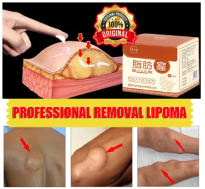 {Promotion} Lipoma Removal Cream Special Gel for Removing Multiple Single Lipoma Subcutaneous Lipoma Lump Bulge