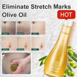 Massage Oil Olive Oil for Skincare and Diminishing Stretch Marks