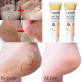 krim kaki pecah dan kering collagen Foot cream kaki pecah Pelembab kaki kering dan pecah Penghalus kaki kasar dan pecah Ultra Pelembab Obat Tumit Kaki Dan Tangan Kering Cream Tumit Kaki Pecah Dan Kering Salep Penghilang Pecah Pecah Di Kaki. 