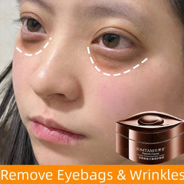 Caviar retinol eye cream eyebag remover eye cream for dark circle ...