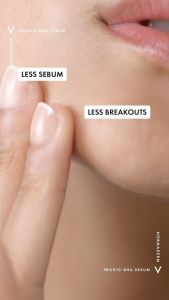 VICHY Normaderm BHA Peeling Serum 30ML