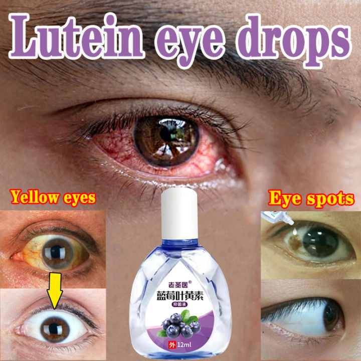 Lutein eye drops for yellow spots on eyes contact lens eye drops