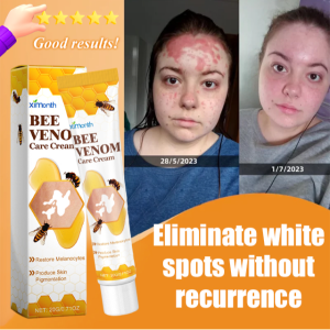 Bee venom whitening cream to reduce white spots
