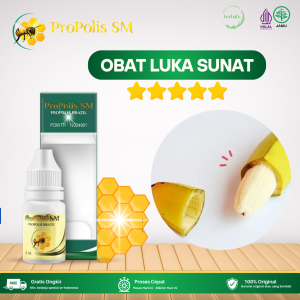 Obat Luka Sunat Obat Pengering Luka Sunat Obat Luka Sunat Lama Kering Obat Lecet Nyeri Dan Perih Obat Luka Berdarah Obat Luka Khitan Obat Luka Sayatan Obat Rasa Gatal Pasca Sunat Dengan Propolis SM