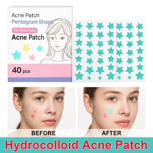 Acne Pimple Patch Cute Hydrocolloid Pimple Removal Stickers Skin Care Beauty Tools