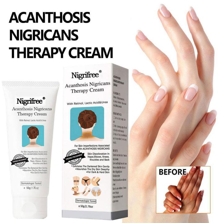 50ml Acanthosis Nigricans Therapy Cream Moisturizing Care Arm W6P0 ...