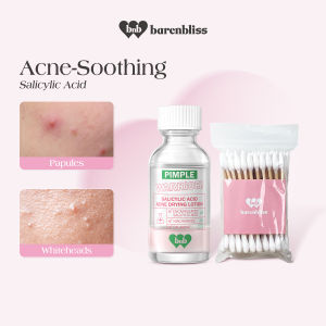BESTSELLER | barenbliss BNB Pimple Warrior! Salicylic Acid Acne Drying Lotion | Acne Spot Treatment