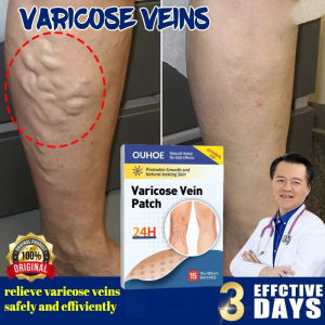 Miếng Dán Thảo Dược Suy Giãn Tĩnh Mạch - Giảm Sưng Đau Làm Mờ Gân Xanh Ngăn Tái Phát