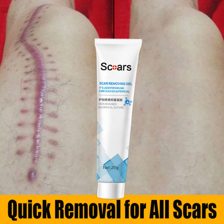 Scar Remover for Old Scar on Leg Scar Gel Original Stretch Mark Remover