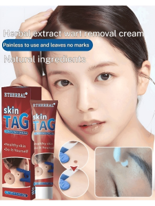 Herbal Wart Remover Wart Cream Wart Cream Wart Cream Wart Cream Wart Cream Wart Cream Wart Cream/Mild and safe wart cream Flat Chicken Eye Cream Convenient and easy to use Quick Powerful wart removal