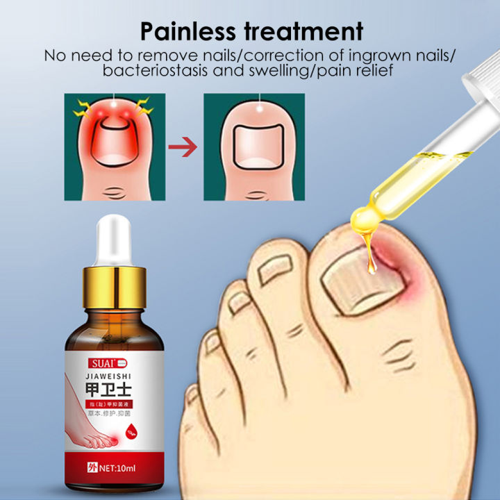 Nail Toenail Antibacterial Essence Ingrown Nail Groove Care Liquid