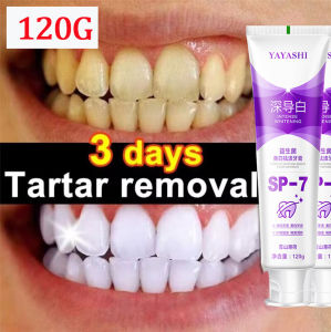 Pasta gigi pemutih gigi SP-7 pasta gigi pasta gigi probiotik pemutih gigi pemutih gigi dan penghilang karang Nafas Segar Menghilangkan Bau Mulut Pasta Gigi Pemutih Mint Merawat Gigi ﻿120G
