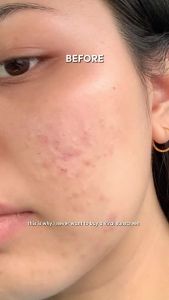 Glad2Glow Moisturizer Niacinamide Brightening / Retinol / Repair / Cenla Acne / 377 Dark Spot Glowing 30g/55g/100g