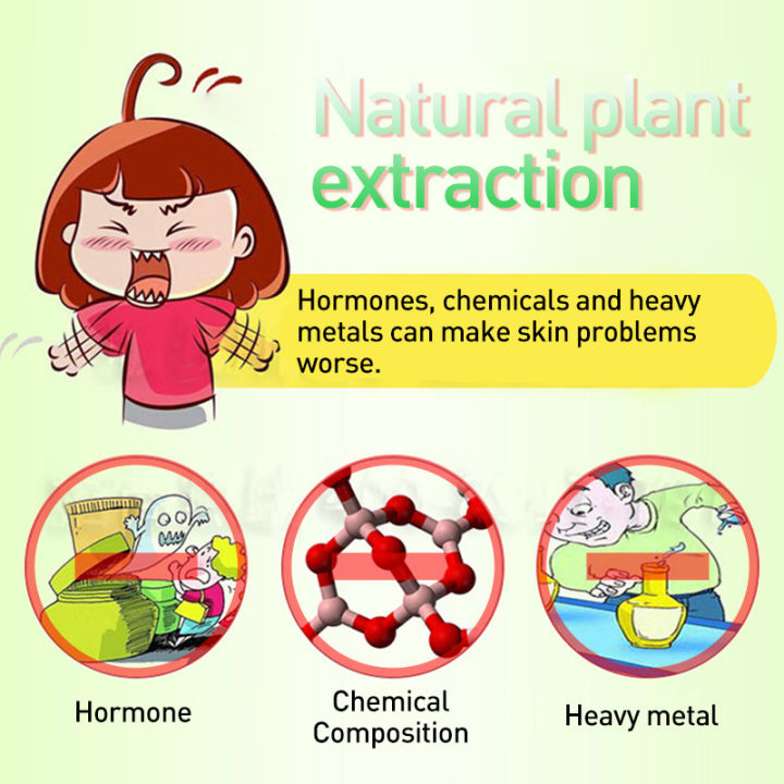 Sumifun Eczema Treatment Cream 100% EFFECTIVE Gamot Sa Kati Kati Sa ...