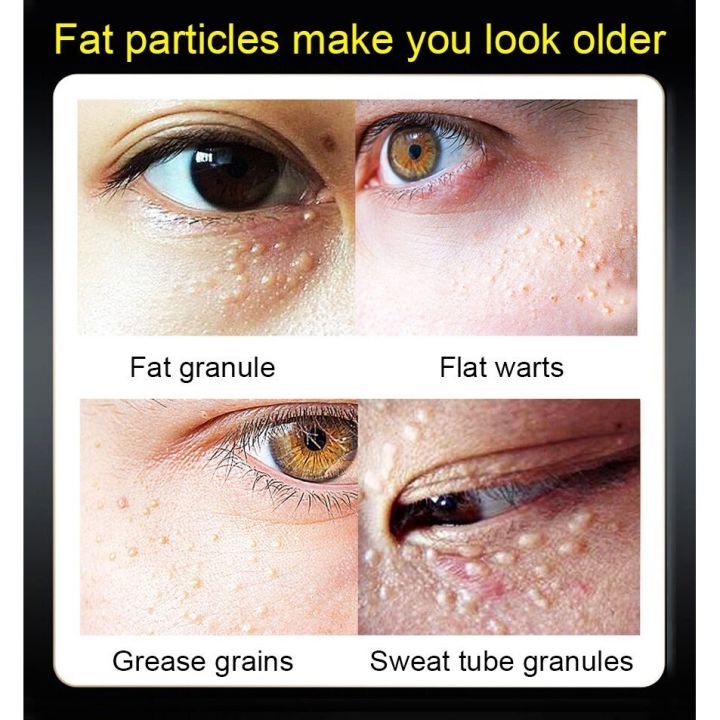 %E3%80%90COD%E3%80%91Eye%20cream%20remove%20repair%20fat%20particles%20eye%20wrinkles%20bags%20under%20the%20eyes%20dilute%20dark%20circles%2020g%20-%20Image%205