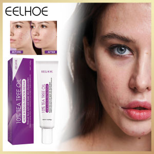 Eelhoe Acne Face Cream Pimple Spot Black Dots Removal Fade Acne Scar Repair Redness Smooth Pores Anti Inflammatory Moisturizing Whitening Blemish Cream Repair Dark Spot Lighten Melanin Freckles Remover Fade Fine Lines Anti Aging Lift Firming Cream