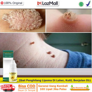 Terbukti Obat Penghilang Papiloma Di Leher Dengan Propolis Sm Asli - Obat Kutil Di Leher - Obat Lipoma - Benjolan Kelenjar Benjolan Lipoma Di Leher Di Kaki Di Tangan Di Punggung Di Ketiak Dan Di Semua Bagian Tubuh -  Obat Tetes Propolis Sm Brazil Ori